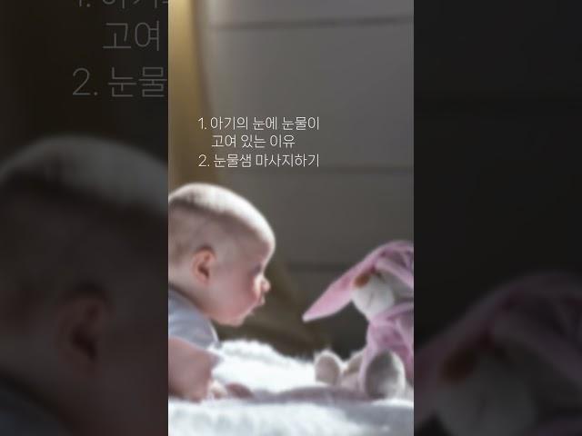 아기 눈과 눈곱 관리 / 아기 시력, 결막염, 사시 / 아기 눈에 안약 넣는 법