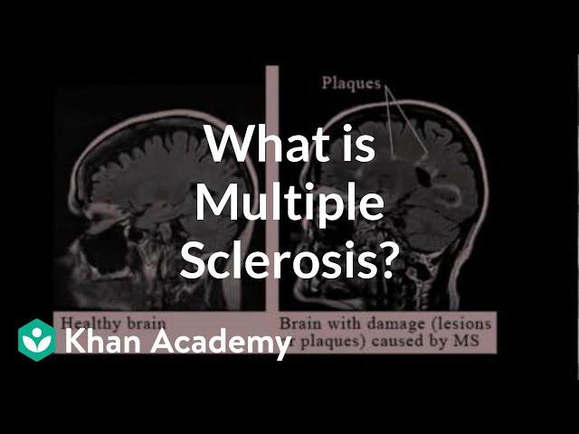 What is multiple sclerosis? | Nervous system diseases | NCLEX-RN | Khan Academy