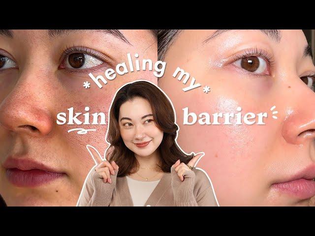 How I heal my Skin Barrier in 1 WEEK~! my skincare routine for irritated skin ‍