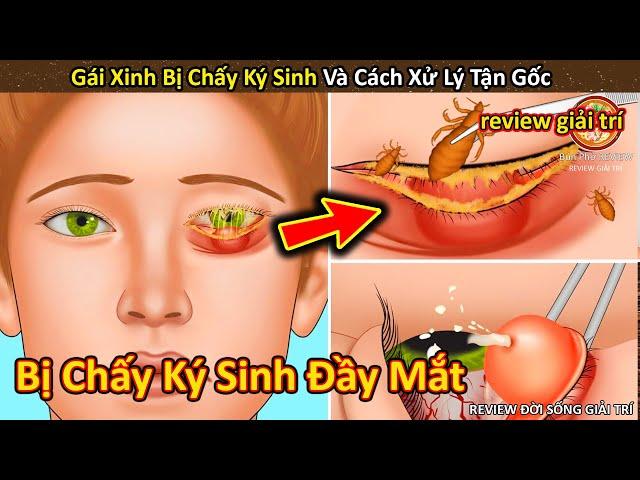 Nhím Cute Review Gái Xinh bị chấy ký sinh và cách diệt tận gốc || Review Giải Trí Đời Sống