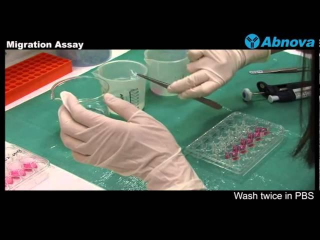 Migration Assay