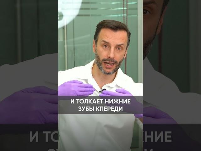 Из чего состоит оппарат форсус / Андрей Жук #Shorts