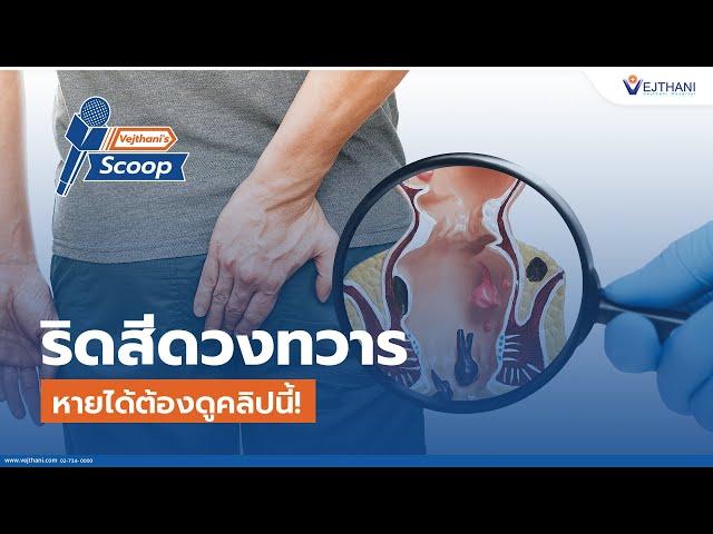 #ริดสีดวงทวาร หายได้ต้องดูคลิปนี้! l Vejthani's Scoop