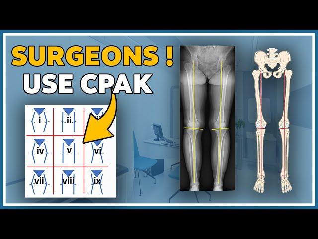 Alignment of the knee with the CPAK classification