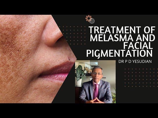 Topical treatment of melasma and facial pigmentation - evidence based review