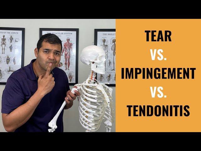 Rotator Cuff Tear VS  Shoulder Impingement VS Shoulder Tendonitis