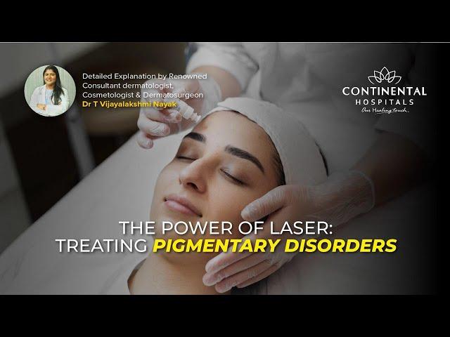 The Power of Laser: Treating Pigmentary Disorders | Continental Hospitals