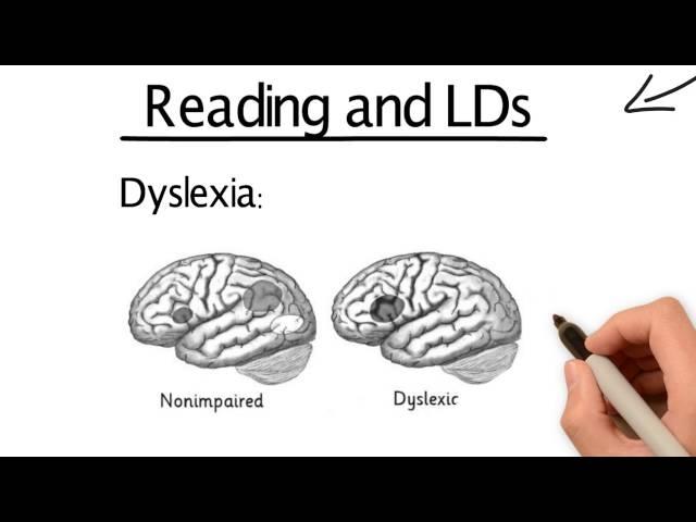 Introduction to LD's - Literacy