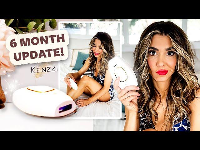 6 Month Update! Does Kenzzi IPL Really Work? | DIY with Orly Shani