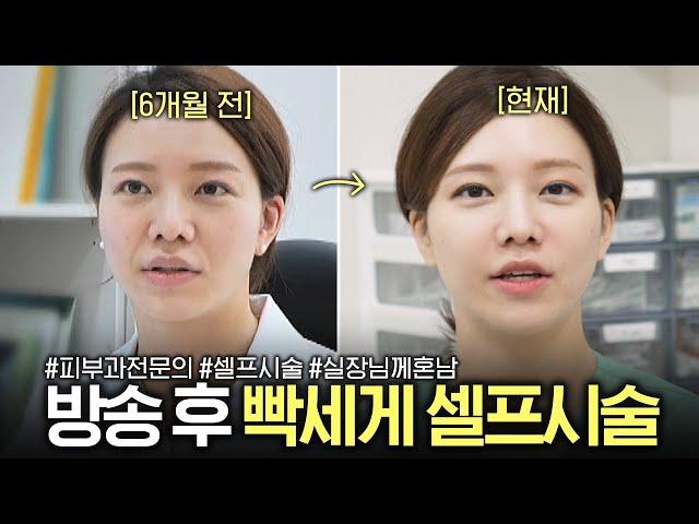 방송 출연 후 실장님한테 혼나서 셀프 쥬베룩 볼륨 시술(피부과 전문의)