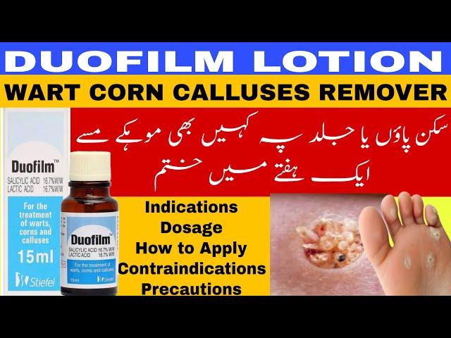 Duofilm lotion | wart remover | mohkay kese khatam krein | warts calluses corn remover medicine