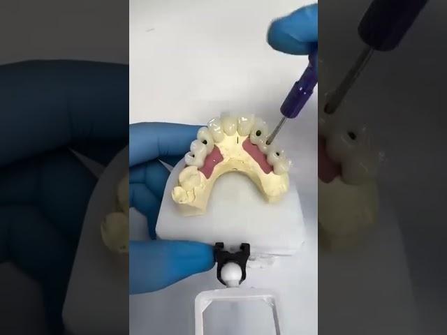 Top U.S. Dental Lab for advanced implant restorations & full-arch solutions! 