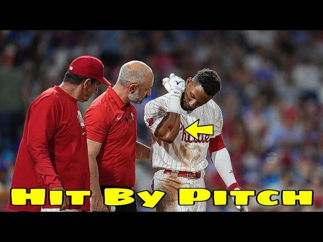 MLB | Worst Hit By pitch July 2024