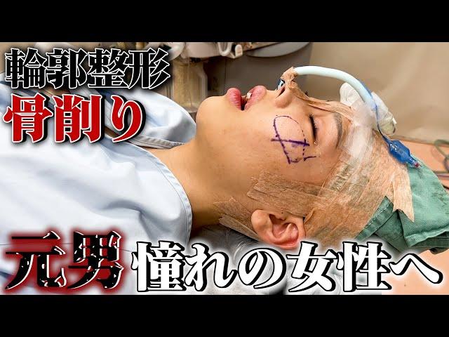 【密着】元男からの脱却..人生をかけた輪郭整形。