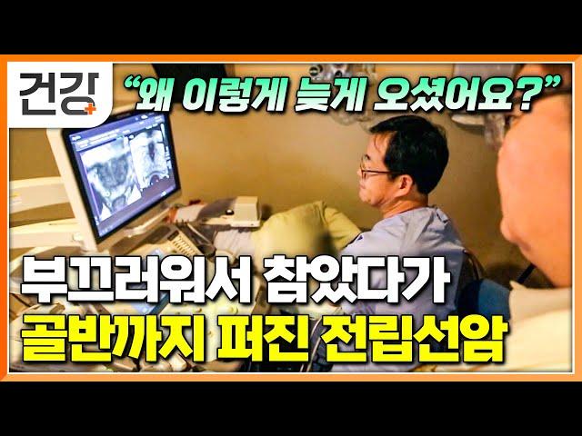 비뇨기과 찾아가기 부끄럽다는 이유로 참고 참았다가 생긴 전립선암 4기의 비극│초기 발견이 중요한 전립선암의 증상│전립선암 치료하는 로봇 수술 과정│명의│#EBS건강