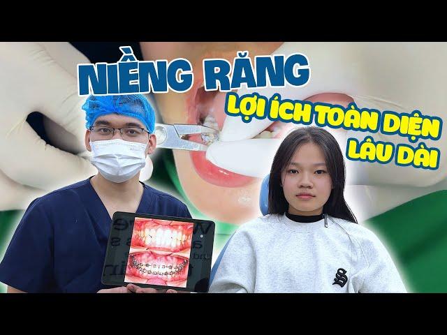 Tháo mắc cài niềng răng Hô, Khấp khểnh - Thay đổi nụ cười sau niềng răng