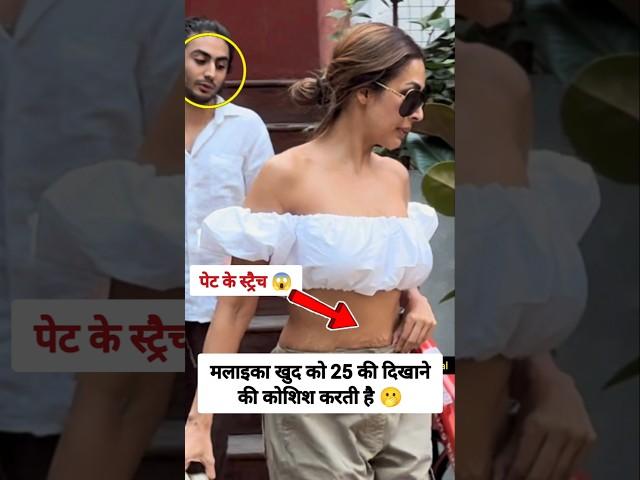 Malaika Arora's Stretch Marks #malaikaarora Gavya Official