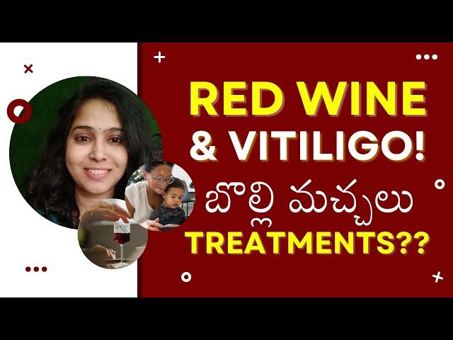 Red Wine & Vitiligo Treatments in Telugu | Dr. Deepthi | crowns clinic