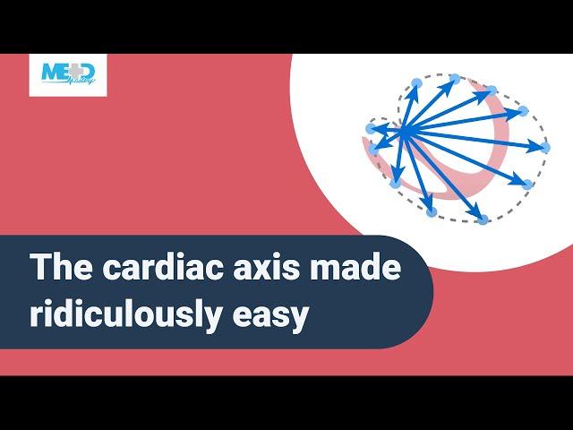 The cardiac axis made ridiculously easy