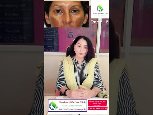 वांग/hyperpigmentation #skincare #doctor #ponds #garnier #skin #viral #trending #ytshorts #youtube