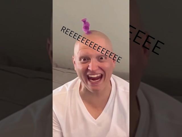 DRIVE-BY  BALD SHOTS‍ #comedy #funny #alopecia @mcsquared90