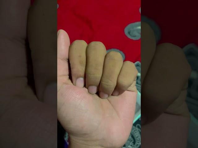 I Have 4 Fingers #shorts