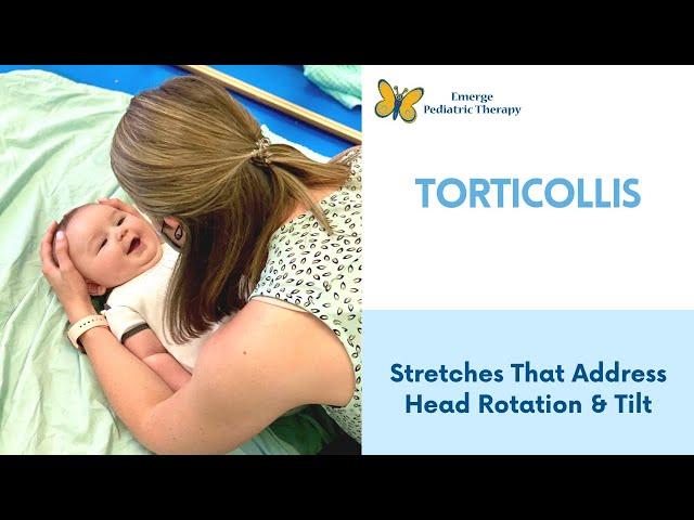 Torticollis: 2 Stretches To Try At Home