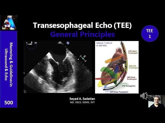 Transesophageal Echo (TEE)1- General Principles