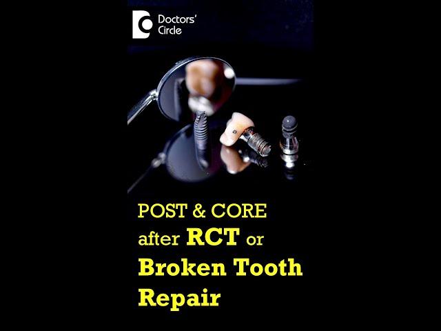 POST & CORE after RCT |Broken Tooth Repair- Dr. Manesh Chandra Sharma| Doctors' Circle #shorts