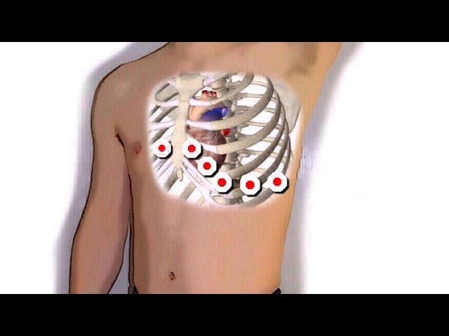 Recording a 12 lead ECG in 5 min