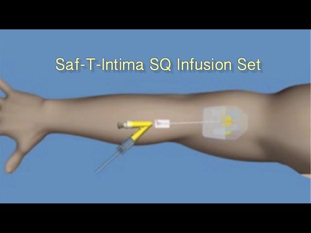 How to Insert Saf-T-Intima™ SQ Infusion Set