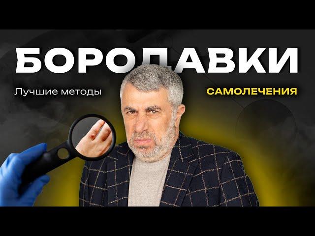 Бородавки: правила профилактики, лечение, самолечение.