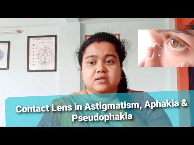 Contact Lens in Astigmatism, Aphakia & Pseudophakia