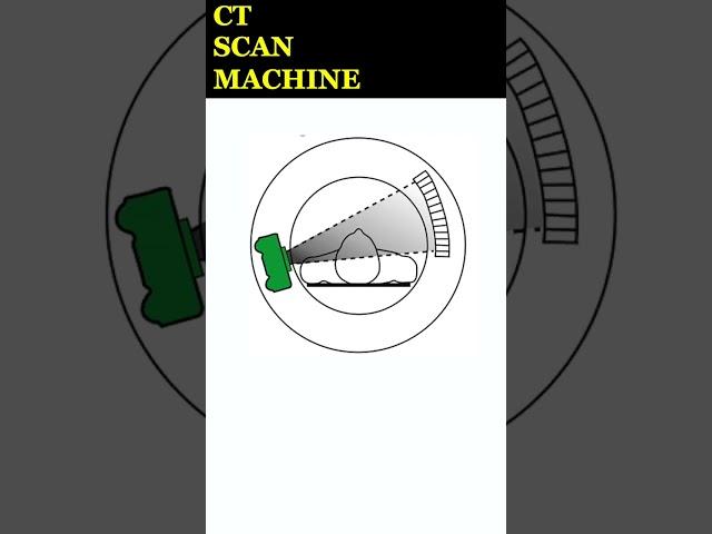 25 seconds explainer: How CT Scan Works #explained #science