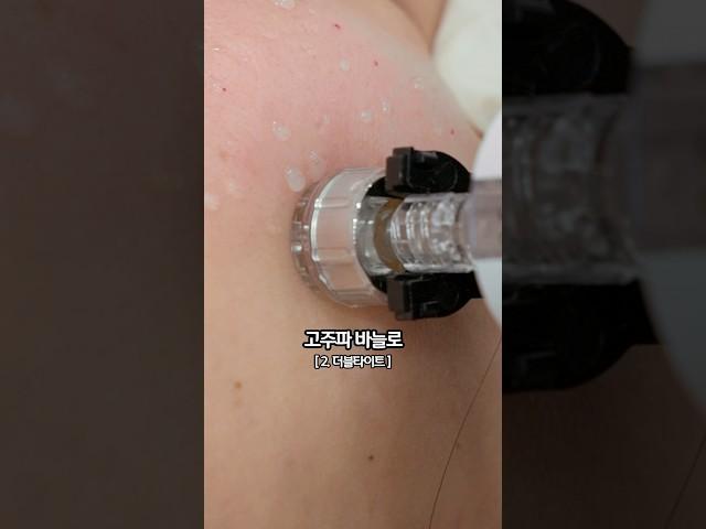절대 실패하지 않는 목주름 3대 치료 