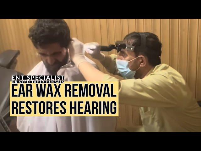 Ear Wax Removal Restores Hearing: Patient Relieved After Successful Ear Cleaning