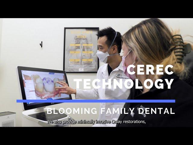 Introducing CEREC Same-Day Crowns