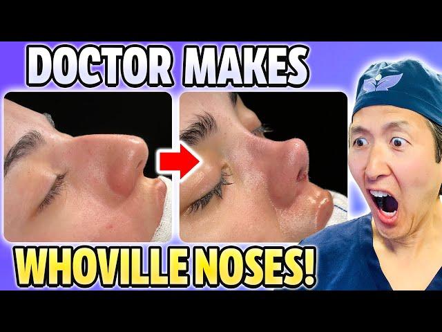 Plastic Surgeon Reacts to EXTREME Nose Jobs From Turkey!