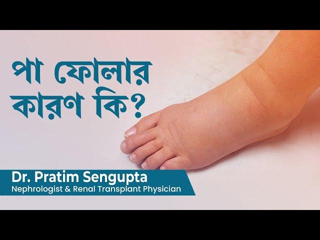 পা ফোলার কারণ কি | Causes for  swollen legs and feet  or Edema in Bengali