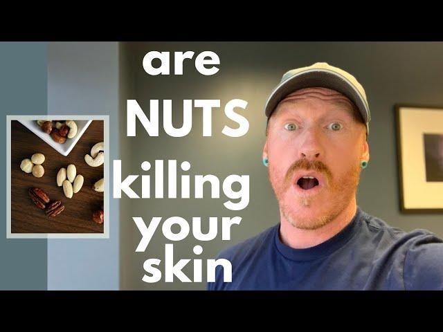 Why 99 % of NUTS are an unhealthy food your skin health / What nuts are SAFE to eat for healthy skin