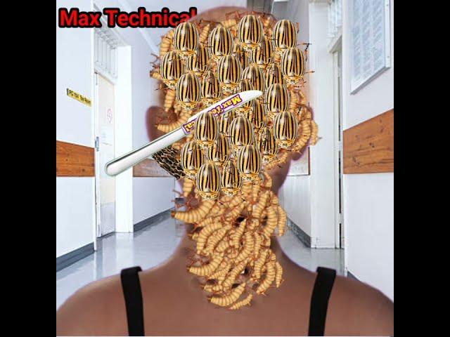 Asmr maggot infected head back side | remove infection maggot animation neck giant @sakirmaxvlogs