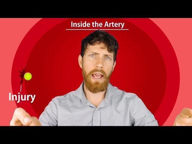 High Cholesterol Doesn't Cause Heart Disease | Debunked