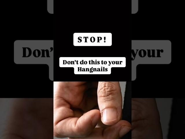 Don’t do this to your hangnails! Here’s What You Should (and Shouldn’t) Do!  #trending