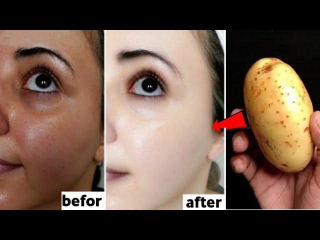 Japanese secret to whitening 10 degrées that eliminates pigmentation and dark spots