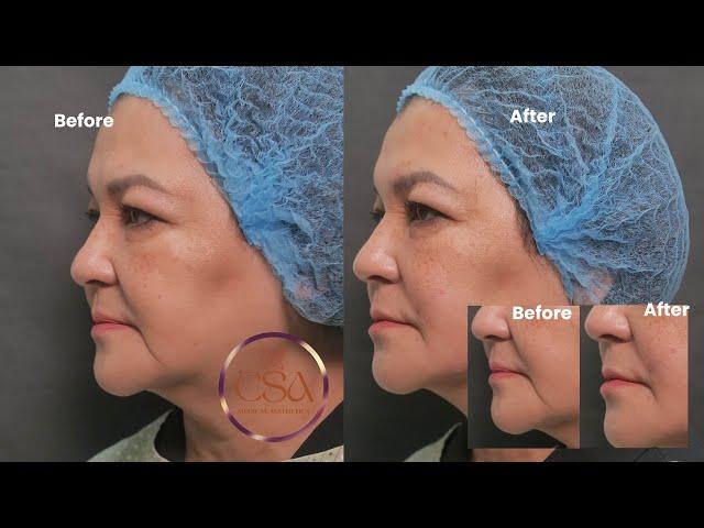 “Maintaining a natural, youthful look for those ages 60 and above “ | Dr. Contessa Salvador - Alapag