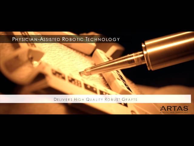 The ARTAS Robotic Hair Restoration Procedure