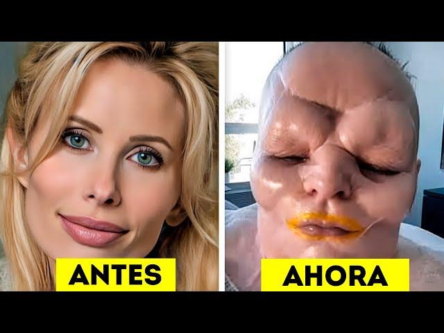 15 TERRIBLES Cirugías Plásticas de Famosos Que Fracasaron