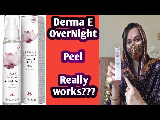 Derma E Overnight Peel REVIEW|Best for Glowing skin and pigmentation |Glowingwithsaima