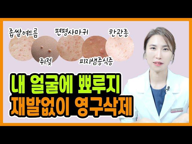 맨날 다시 올라오는 비립종, 한관종, 편평사마귀 등 "현직 한의사가 알려주는 얼굴 피부 요철 홈케어 방법"