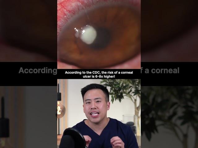 Contact Lens Infection.